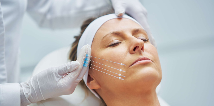 Thread Lift Treatment in Kandivali East and West - Dr. Pinky Mehta