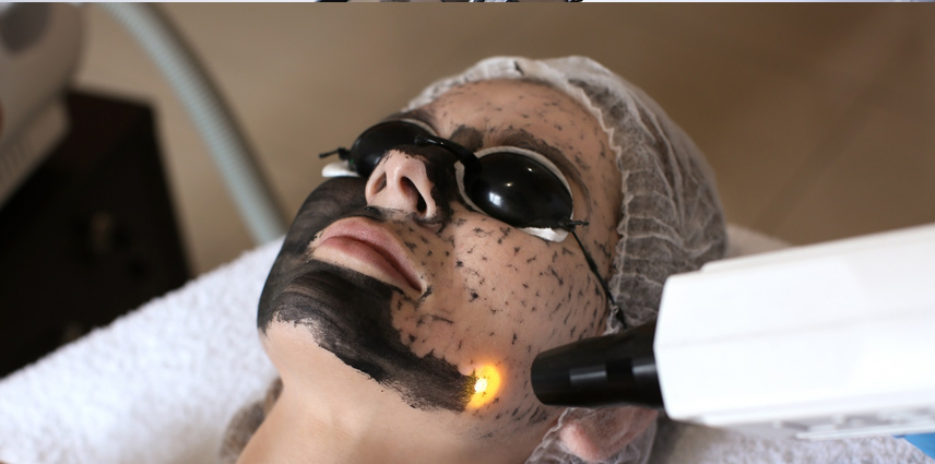 Laser Toning and Carbon Facial in Kandivali East and West - Dr. Pinky Mehta