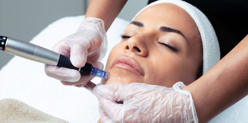 Microneedling Dermapen Treatment in Kandivali East and West - Dr. Pinky Mehta